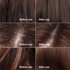 Centella Scalp Scrub – Exfoliating Hair & Scalp Care Treatment